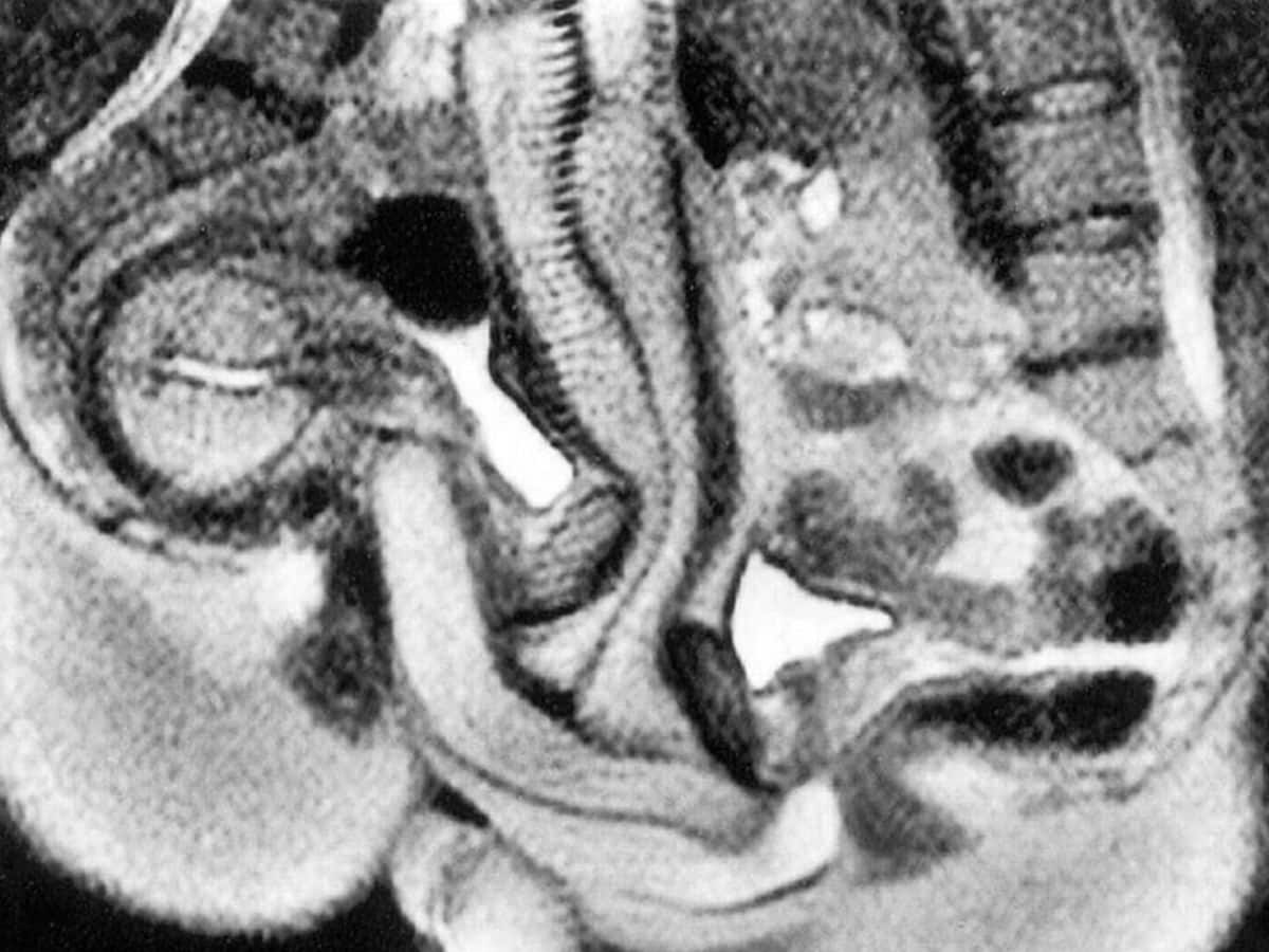 1 6f49b7d42e7eaa90aa83b46915241179jpeg