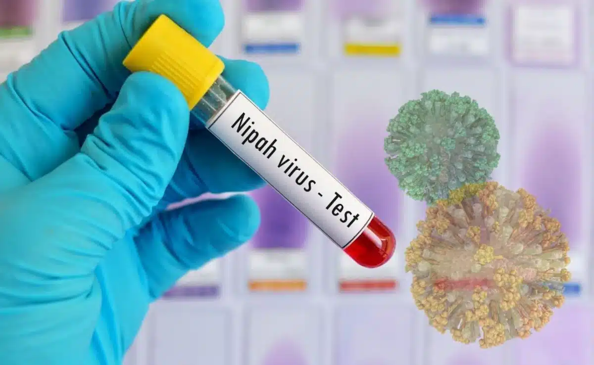 Η νέα έξαρση του ιού Νίπα προκαλεί παγκόσμια ανησυχία στους επιστήμονες 4