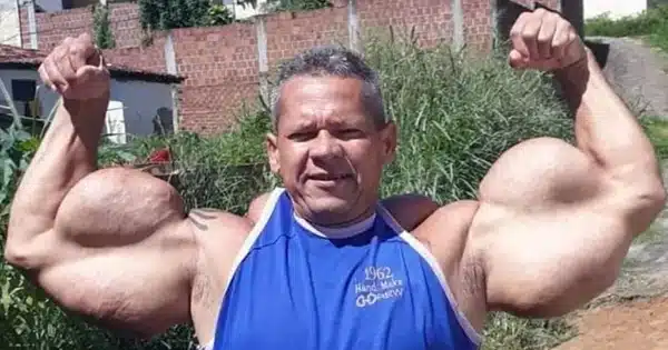 arlindo de souza o montanha tambem conhecido como o popeye brasileiro 3095817