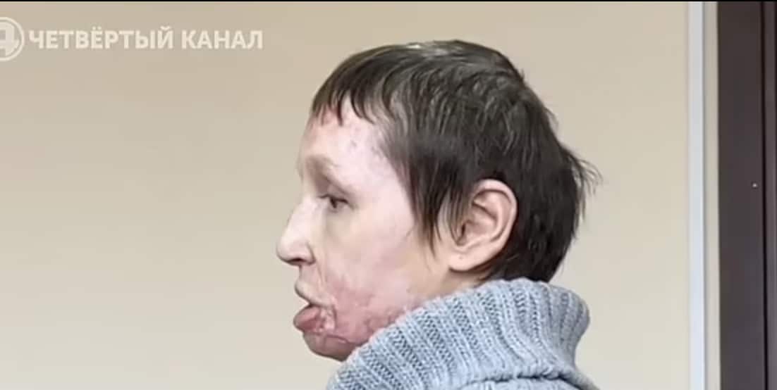 stigmiotypo othonis 2024 07 19 13.54.11