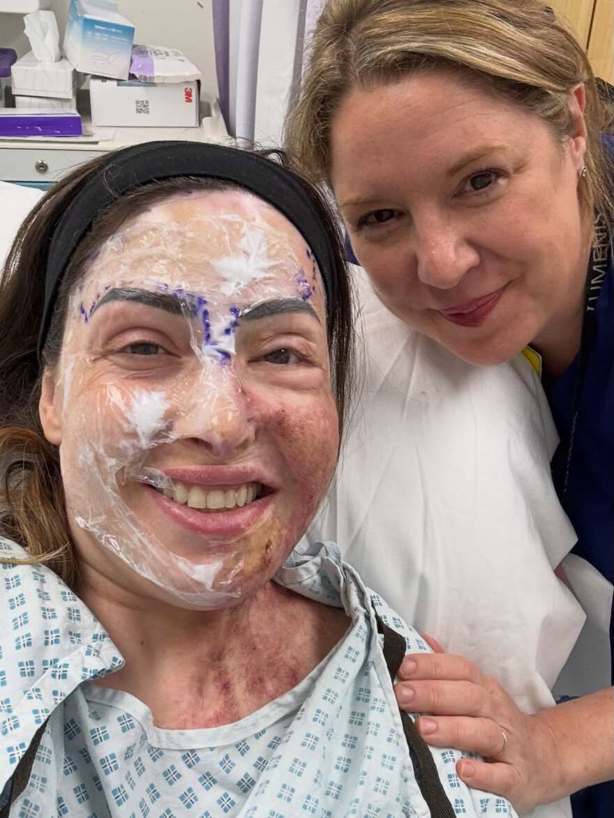 Συγκλονίζει η Ιωάννα Παλιοσπύρου με φωτογραφίες από την αποκατάστασή της: Χτίζω τον εαυτό μου ξανά