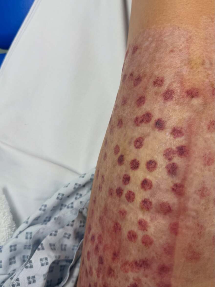 Συγκλονίζει η Ιωάννα Παλιοσπύρου με φωτογραφίες από την αποκατάστασή της: Χτίζω τον εαυτό μου ξανά