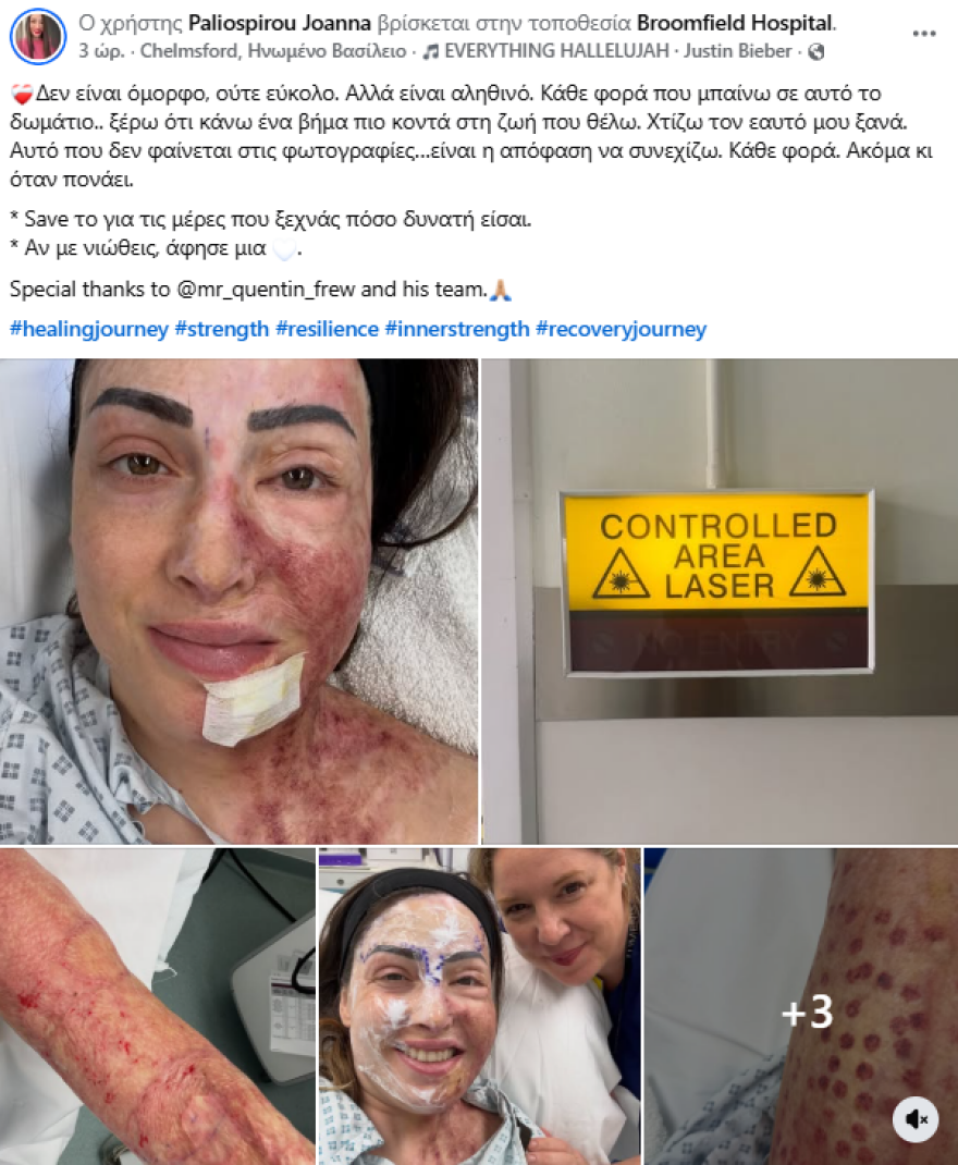 Συγκλονίζει η Ιωάννα Παλιοσπύρου με φωτογραφίες από την αποκατάστασή της: Χτίζω τον εαυτό μου ξανά