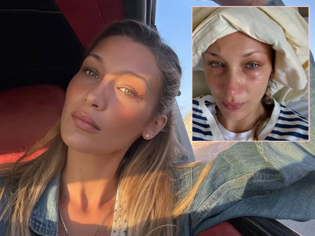 bella hadid health update 1024x768 1